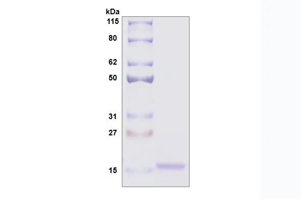 [MC06-100] Recombinant Human Galectin 10, His Tag -100 ug
