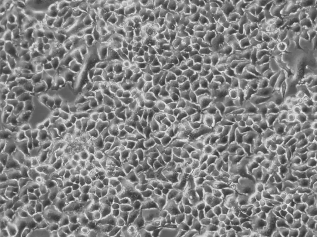 NS3-CMPK-hLBR1TM-mEGFP Cells