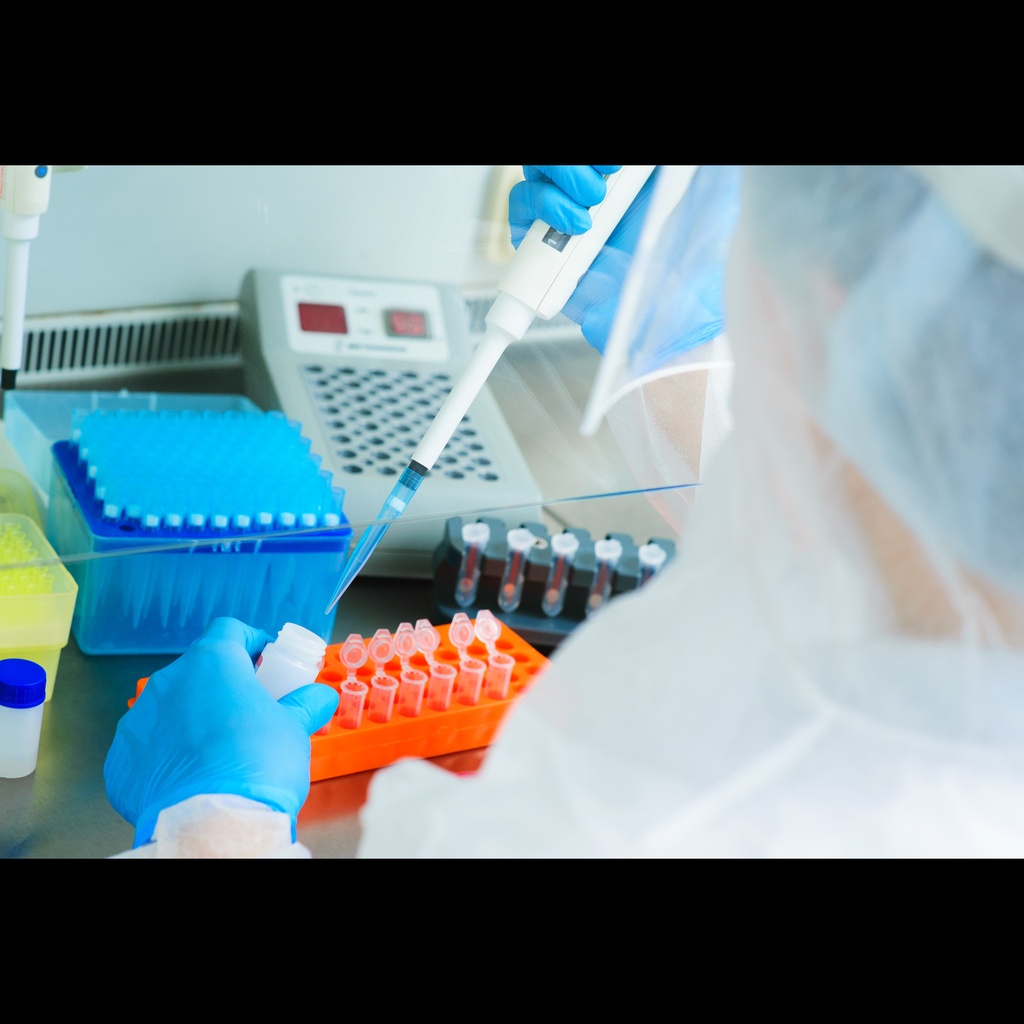 Corynebacterium diphtheriae Endsize:point PCR Kit size: 48 Reactions