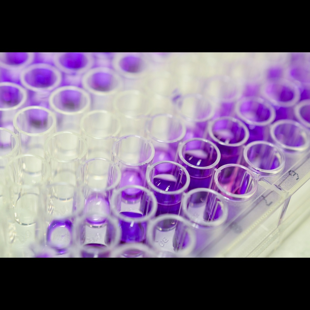 Human Bsize: and Tsize:lymphocyte attenuator BTLA  ELISA kit  96 Tests